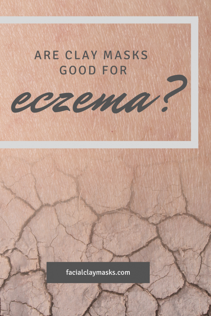 Help, I'm itchy! Are Clay Masks good for Eczema?
