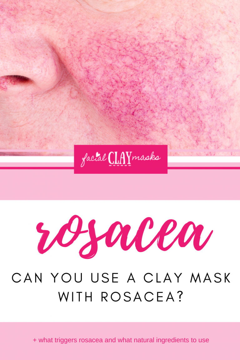Are Clay Masks good for Rosacea? by Facial Clay Masks